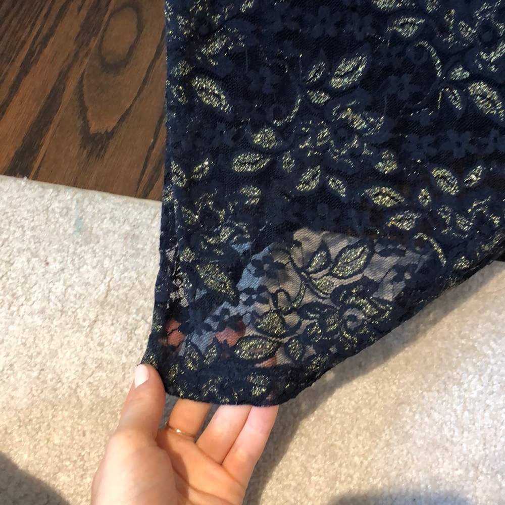 Forever 21 Blue Gold Lace Dress - Picture 7 of 8